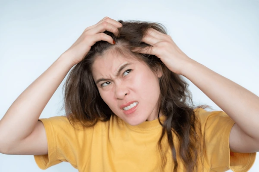 Woman in a yellow shirt scratching her scalp with a frustrated expression, showing signs of hair and scalp concerns.